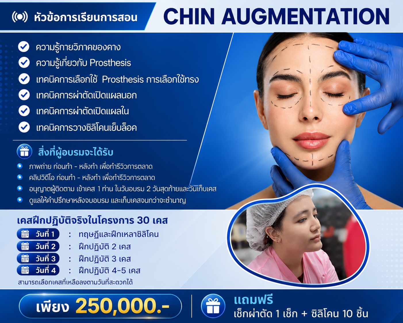 Chin Augmentation